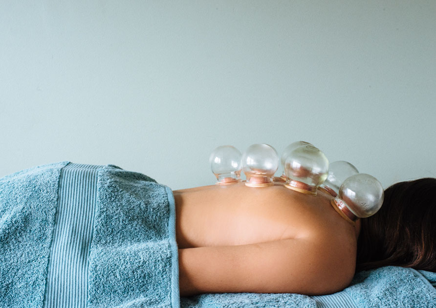 Oriental Therapies - Cupping