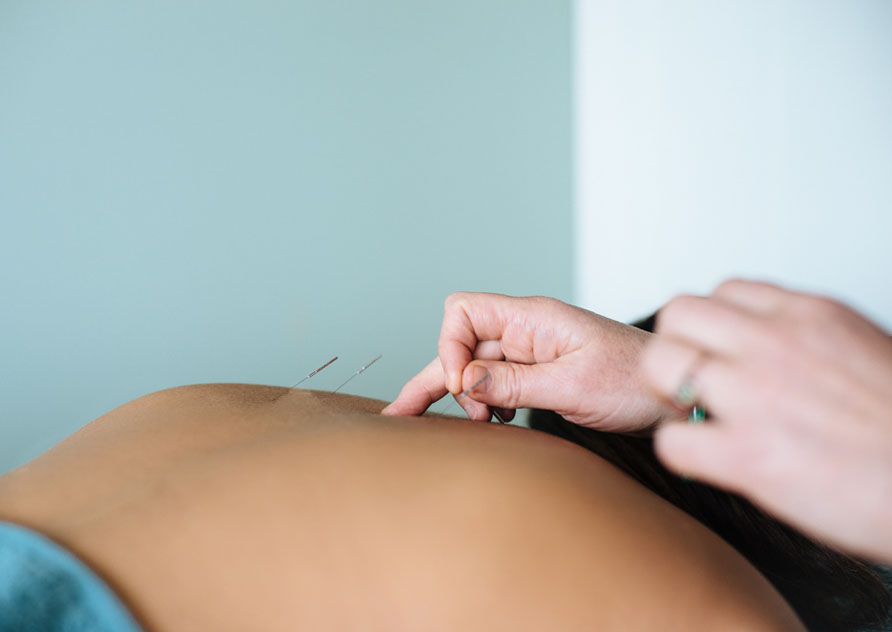 Services - Acupuncture, Massage, Fertility, Paediatric, NST Bowen