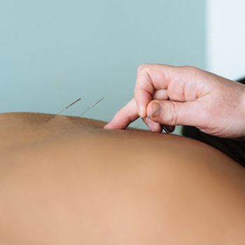 Acupuncture Clinic in Macleod Victoria