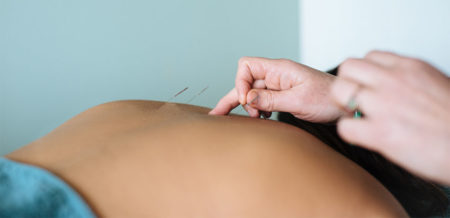 Acupuncture Clinic in Macleod Victoria