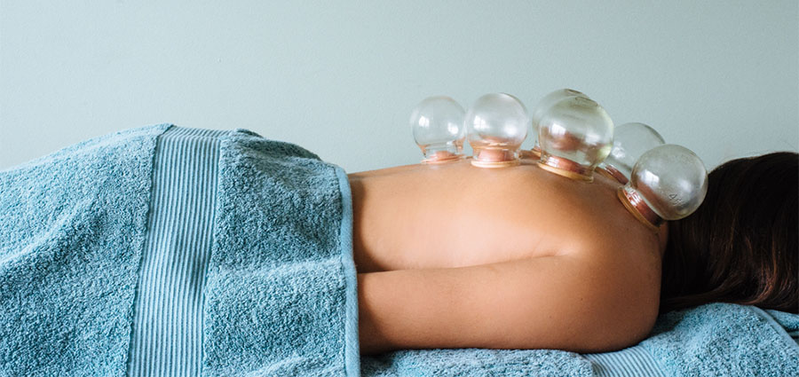 cupping acupuncture clinic macleod victoria