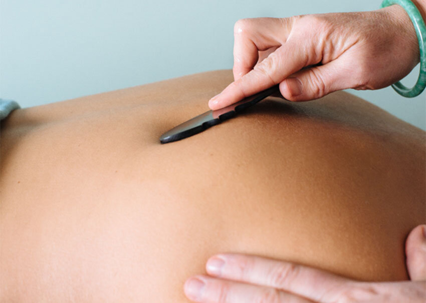 guasha acupuncture clinic macleod victoria