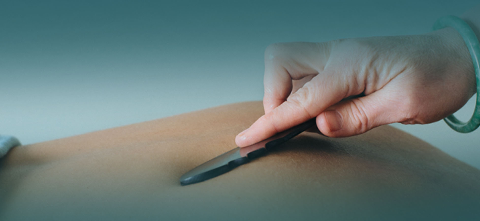 natural health options renew acupuncture clinic macleod victoria